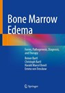Bone Marrow Edema - Reiner Bartl ; Christoph Bartl ; Harald Marcel Bonél ; Emmo von Tresckow - 9783662723203
