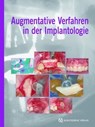 Augmentative Verfahren in der Implantologie - Fouad Khoury - 9783868670240