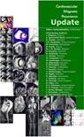 Cardiovascular Magnetic Resonance Update - J. Schwitter ; J. Bogaert ; C. Bucciarelli-Ducci ; O. Bruder ; J-P. Carpenter ; M. Francone ; H. Frank ; B.L.M. Gerber ; S. Greulich ; G. Hindricks ; C. Jahnke ; M. Lombardi ; R. Luechinger ; H. Mahrholdt ; S. Mavrogeni ; P. Monney ; T. Murphy ; V. Muthur - 9783987563386