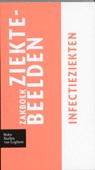 Zakboek ziektebeelden Infectieziekten -  - 9789031364671