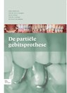 De partiele gebitsprothese - N.H.J. Creugers ; D.J. Witter ; C. de Baat ; H.M.A.M. Keltjens - 9789031375752
