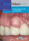 Aandoeningen van het mondslijmvlies - Isaac van der Waal - 9789089761224