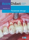 Parodontale chirurgie - Alexander Verhelst - 9789089764577