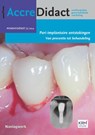 Peri-implantaire ontstekingen - Yvonne de Waal ; Gordon van der Avoort ; Erik Blom ; Jarno Hakkers - 9789089765338
