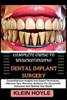 Complete Guide to Understanding Dental Implant Surgery: Comprehensive Insights Into Expert Techniques, Aftercare Tips, Recovery Guidance For Successfu - Klein Hoyle - 9798328911320