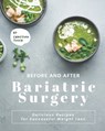 Before and After Bariatric Surgery - Christina Tosch - 9798731528597