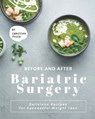 Before and After Bariatric Surgery - Christina Tosch - 9798731528627