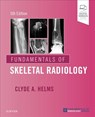 Fundamentals of Skeletal Radiology - Clyde A. (Professor of Radiology and Orthopaedic Surgery Helms - 9780323611657