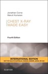 Chest X-Ray Made Easy - Jonathan Corne ; Maruti Kumaran - 9780702055003