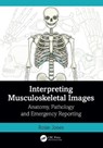 Interpreting Musculoskeletal Images - Rosie (Uni Hospitals of North Midlands) Jones - 9781032398914