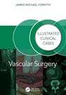 Vascular Surgery: - James Forsyth - 9781032804828