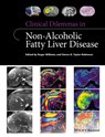Clinical Dilemmas in Non-Alcoholic Fatty Liver Disease - Roger Williams ; Simon D. Taylor-Robinson - 9781118912034