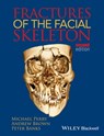 Fractures of the Facial Skeleton - Michael Perry ; Andrew Brown ; Peter Banks - 9781119029342