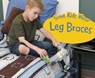 Some Kids Wear Leg Braces - Lola M. Schaefer - 9781474756907