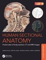 Human Sectional Anatomy - Adrian Kendal (Emeritus Professor Dixon ; David J. (Abdominal Imaging Fellow Bowden ; Bari M. (Formerly University Prosector Logan ; Harold (Harold Ellis CBE FRCS is Emeritus Professor of Surgery Ellis - 9781498708548
