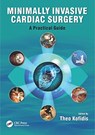 Minimally Invasive Cardiac Surgery - Theo (National University Health System Kofidis - 9781498736466