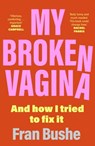My Broken Vagina - Fran Bushe - 9781529347661