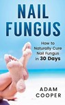 Nail Fungus: How to Naturally Cure Nail Fungus in 30 Days: Natural remedies, homeopathy for toenail fungus - Adam Cooper - 9781539416098