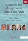 Evaluation and Management of Cleft Lip and Palate - David J. Zajac ; Linda D. Vallino-Napoli - 9781635505351