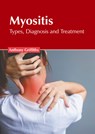 Myositis: Types, Diagnosis and Treatment - Anthony Griffiths - 9781646466290