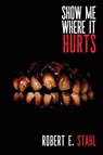 Show Me Where It Hurts - Robert E. Stahl - 9781685101565
