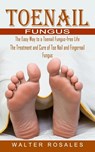 Toenail Fungus - Walter Rosales - 9781774854709
