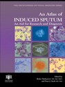 An Atlas of Induced Sputum - Ratko Djukanovic ; Peter Sterk - 9781842140055