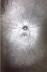Supplement 3: The Invention and Conclusion of the Eye - Toril Johannessen - 9781927354346
