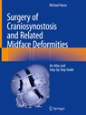 Surgery of Craniosynostosis and Related Midface Deformities - Michael Rasse - 9783031491016