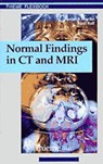 Normal Findings in CT and MRI, A1, print - Torsten Bert Moeller ; Emil Reif - 9783131165213