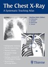 The Chest X-Ray - Matthias Hofer - 9783131442116