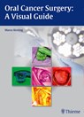 Oral Cancer Surgery - Marco Kesting - 9783131994011