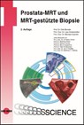 Prostata-MRT und MRT-gestützte Biopsie - Dirk Blondin ; Lars Schimmöller ; Michael Quentin - 9783837415896
