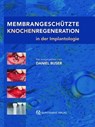 Membrangeschützte Knochenregeneration in der Implantologie - Daniel Buser - 9783868670233