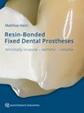 Resin-Bonded Fixed Dental Prostheses - Matthias Kern - 9783868674071