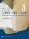 Adhäsivbrücken - Matthias Kern - 9783868674125