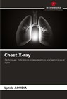 Chest X-ray - Lynda Aoudia - 9786208570392