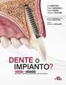 Dente o impianto? - Pio Bertani ; Paolo Generali ; Fabio Gorni ; Tiziano Testori - 9788821454332