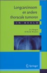 Longcarcinoom en andere thoracale tumoren in beeld - J.A. Burgers ; M. Wouters - 9789031362615