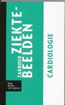 Zakboek ziektebeelden Cardiologie -  - 9789031364589