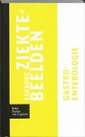 Zakboek ziektebeelden Gastro-enterologie -  - 9789031364596