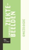 Zakboek ziektebeelden Oncologie -  - 9789031364909