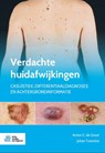 Verdachte huidafwijkingen - Anton  C. de Groot ; Johan Toonstra - 9789036824668