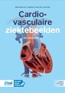 Cardiovasculaire ziektebeelden - C. Klöpping ; R. Jansen ; M. G. van der Meer - 9789036831154