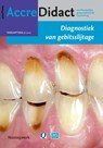 Diagnostiek van gebitsslijtage - Peter Wetselaar ; Frank Lobbezoo - 9789089761866