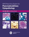 Who Reporting System for Pancreaticobiliary Cytopathology - Iac-Iarc-Who Joint Editorial Board - 9789283245186