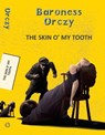 Skin O' My Tooth - Baroness Emma Orczy - 9789357310734