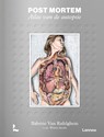 Post mortem. Atlas van de autopsie - Babette Van Rafelghem ; Werner Jacobs - 9789401491778