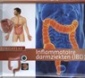 Inflammatoire darmziekten (IBD) - Jeroen Jansen ; Mirjam Traube ; Karin Fienieg ; Eugenie Le Poole - 9789491984358