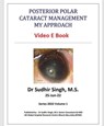 Posterior Polar Cataract Management: My Approach - Sudhir Singh - 9798201084349